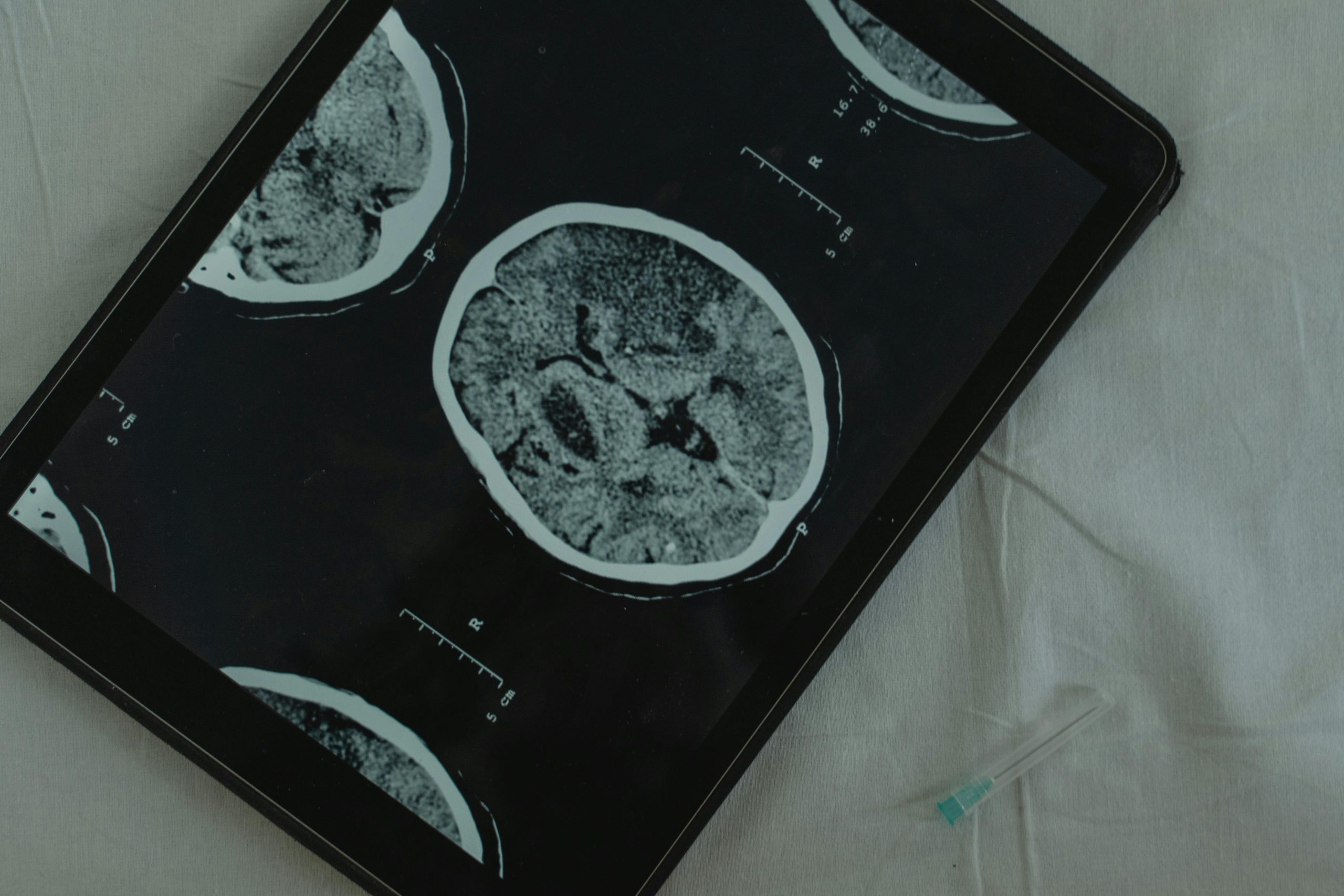 Temperature Regulation following a Brain Injury